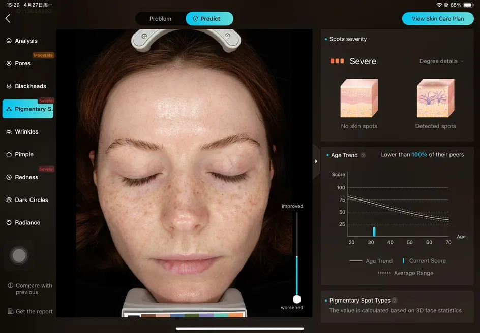 Predictive skin ageing
