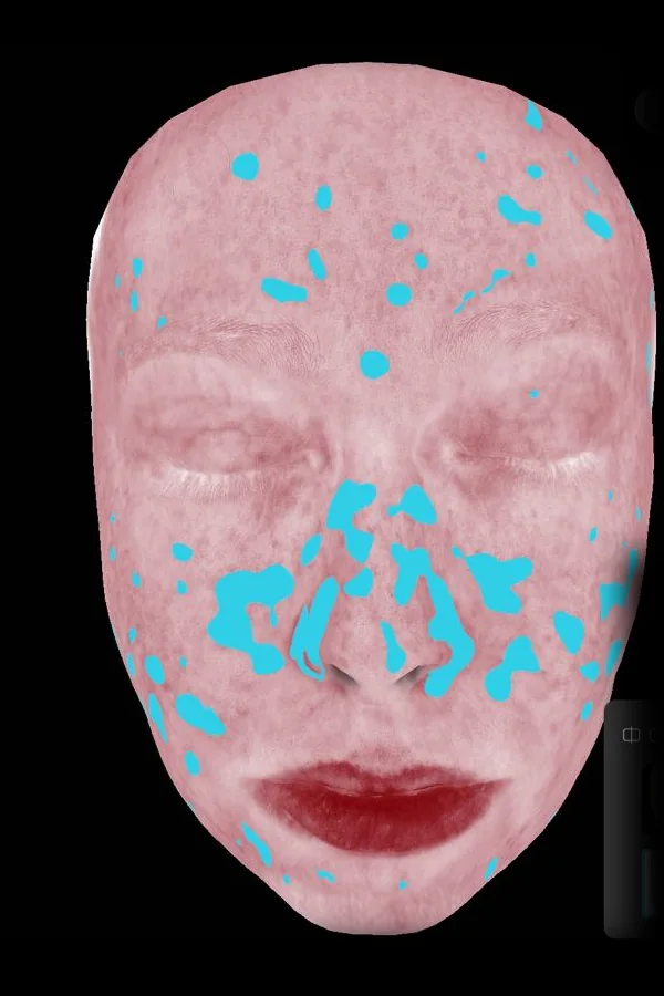 Redness map
